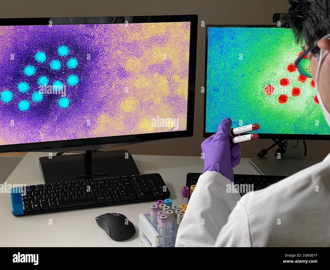 Laboratory technician doing research with images of hepatitis A virus on computer. Stock Photo