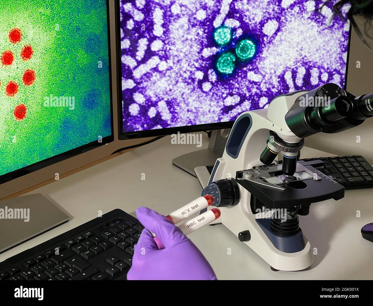 Laboratory assistant doing research with images of hepatitis A and B virus on computer. Stock Photo