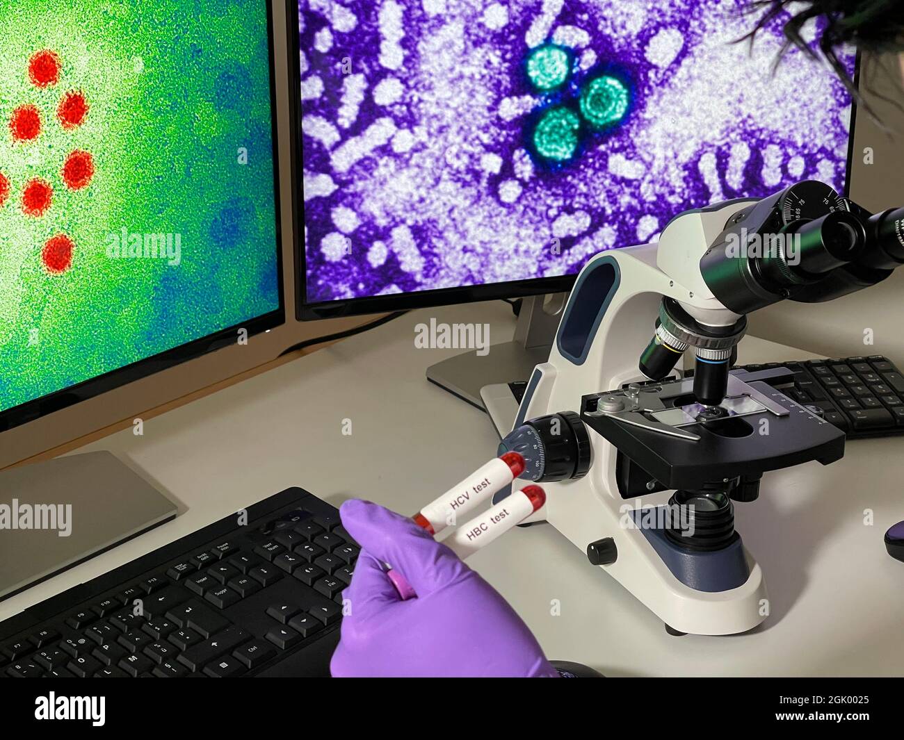 Laboratory assistant doing research with images of hepatitis A and B virus on computer. Stock Photo