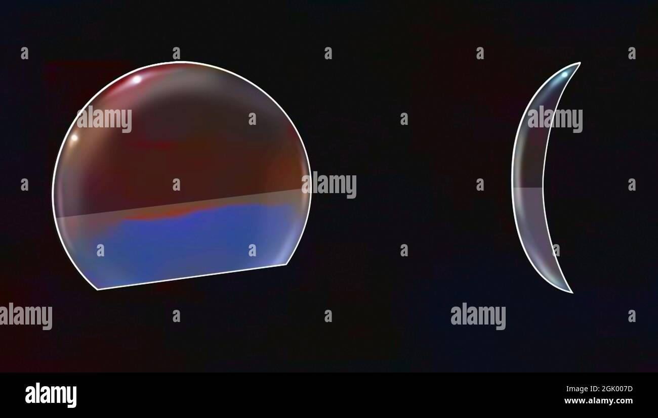 Correction of presbyopia: segmented alternating vision contact lens. Stock Photo