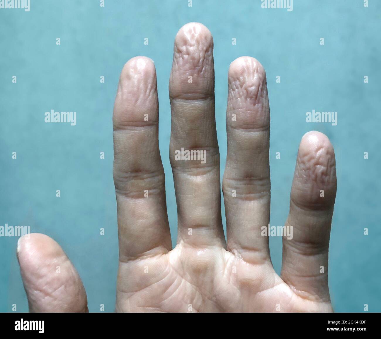Cold hands finger tips hires stock photography and images Alamy