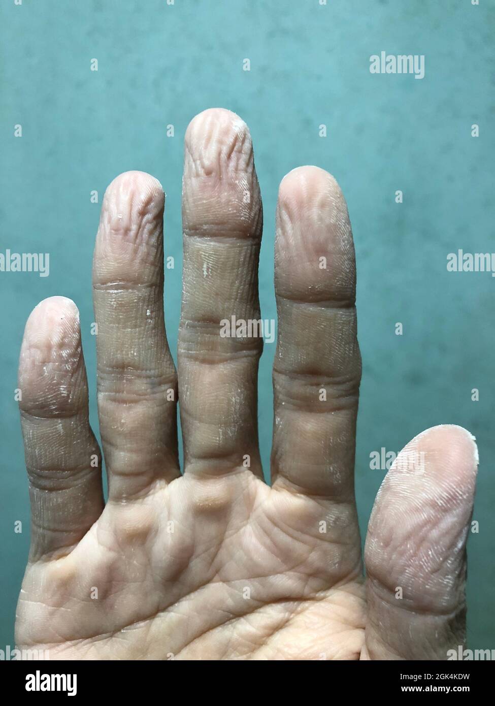Tips for rough hands hires stock photography and images Alamy