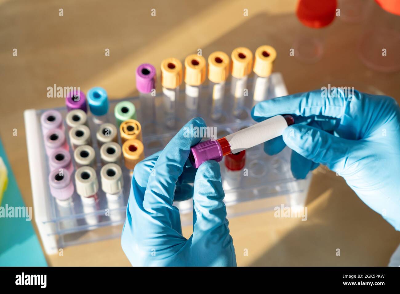 Laboratory technician performing blood tests in the laboratory Stock ...