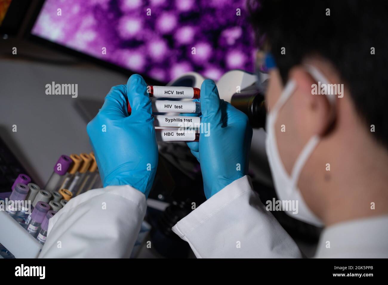 Blood tests to detect sexually transmitted diseases or STDs hepatitis B and C, syphilis, HIV