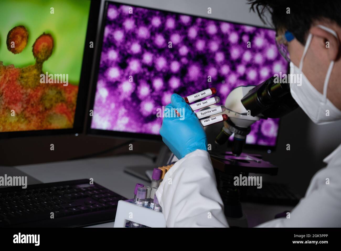 Blood tests to detect sexually transmitted diseases or STDs hepatitis B and C, syphilis, HIV