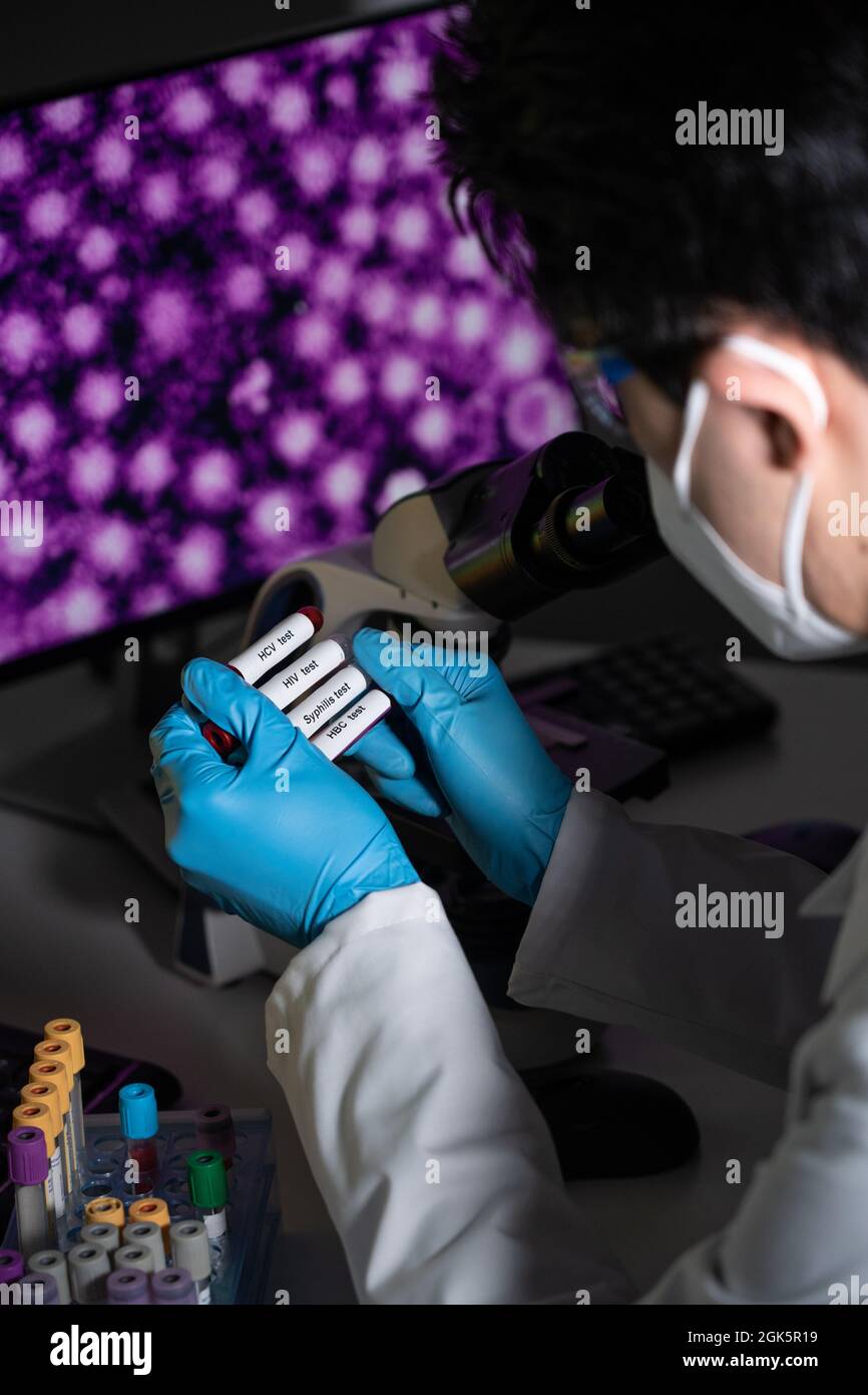 Blood tests to detect sexually transmitted diseases or STDs hepatitis