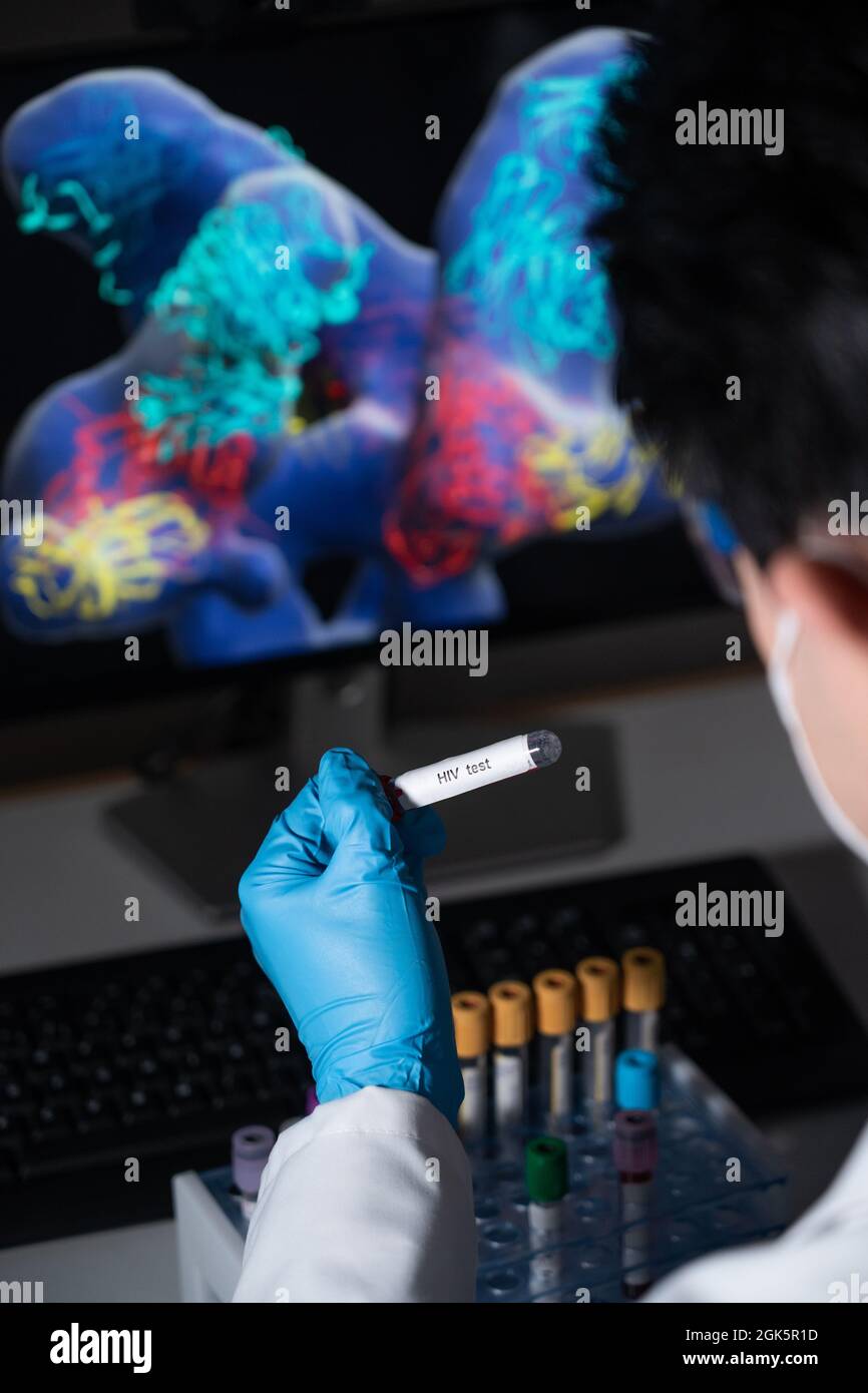 Blood tests to detect sexually transmitted diseases or STDs hepatitis B and C, syphilis, HIV