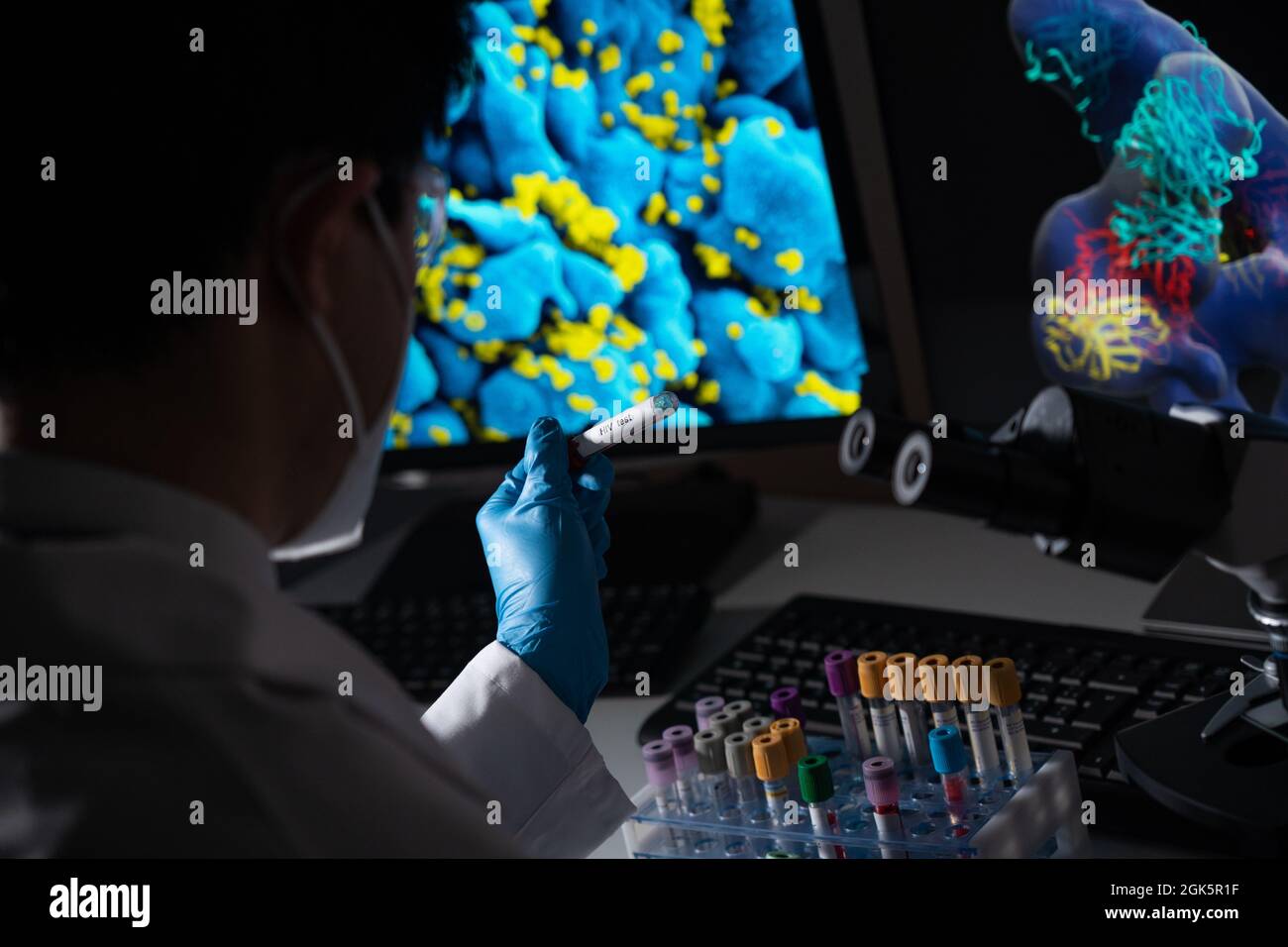 Blood tests to detect sexually transmitted diseases or STDs hepatitis