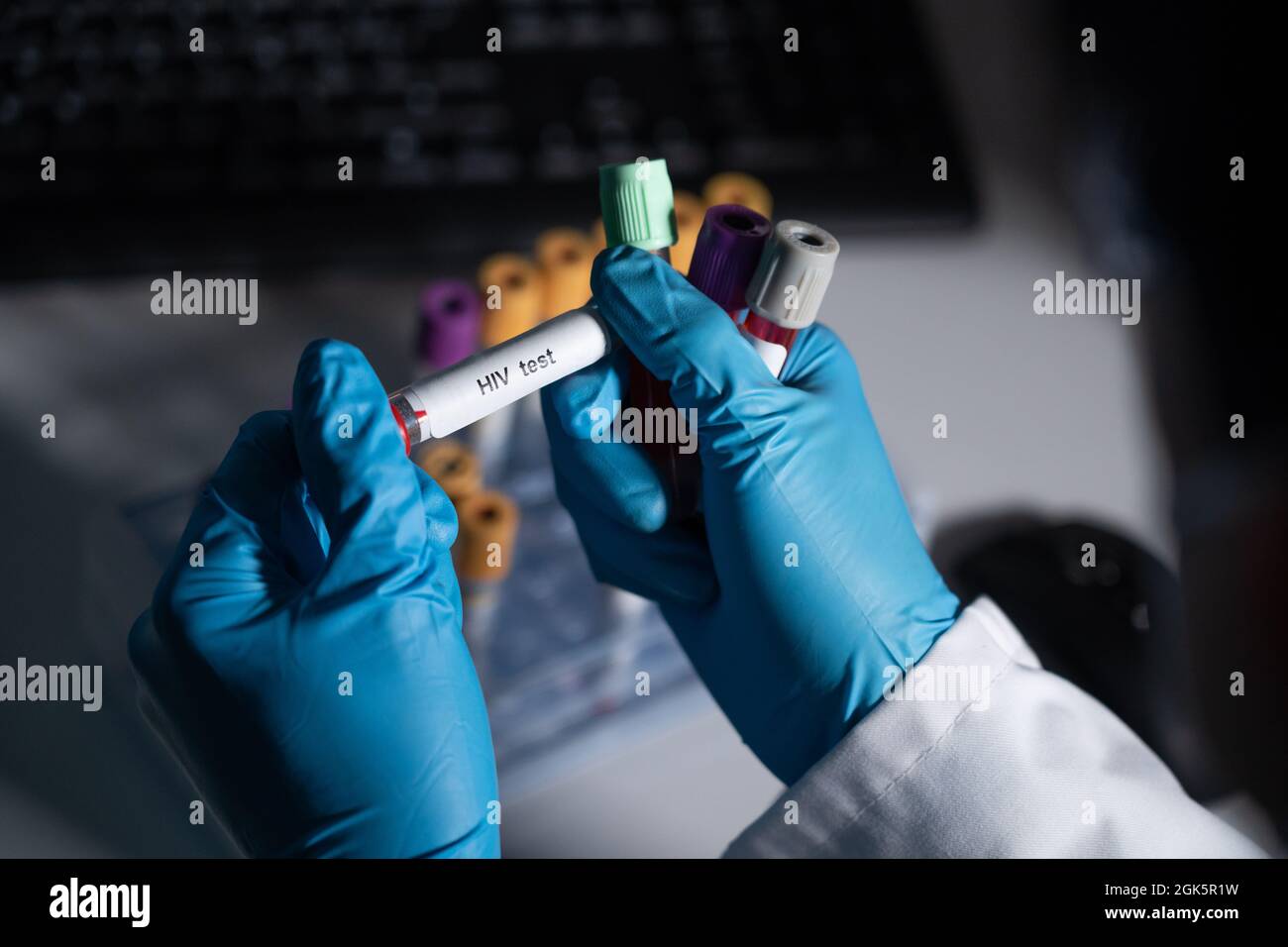 Blood tests to detect sexually transmitted diseases or STDs hepatitis