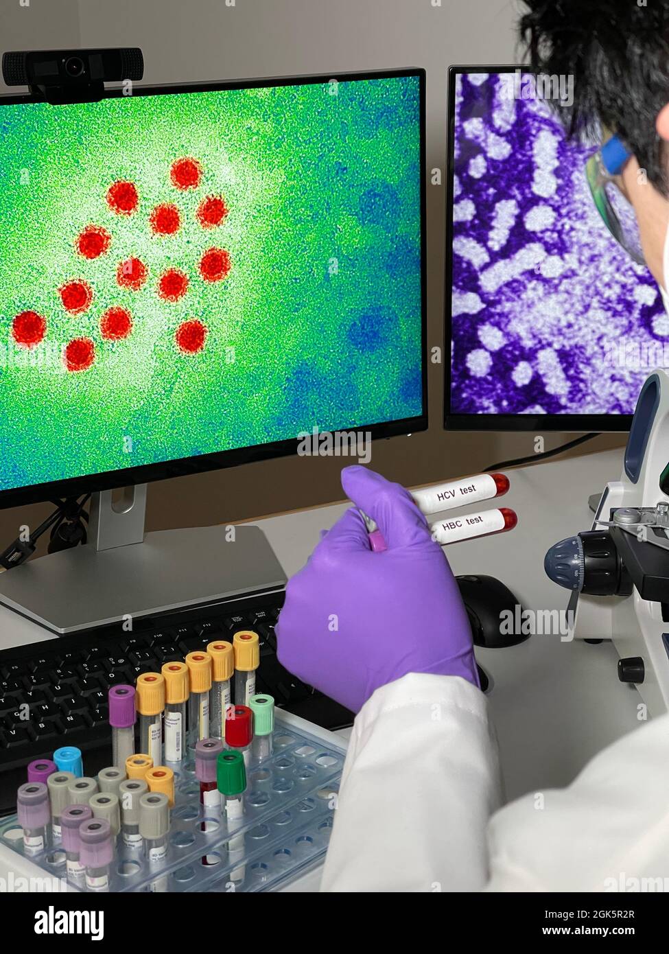 Laboratory assistant doing research with images of hepatitis A and B virus on computer. Stock Photo