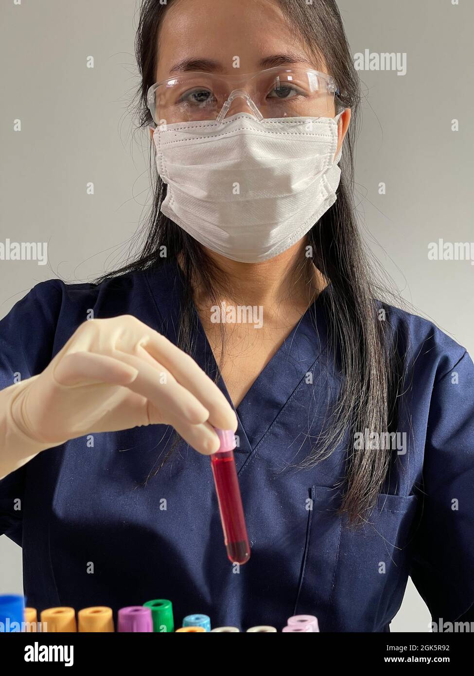 Serological test done with a blood test to look for the presence of