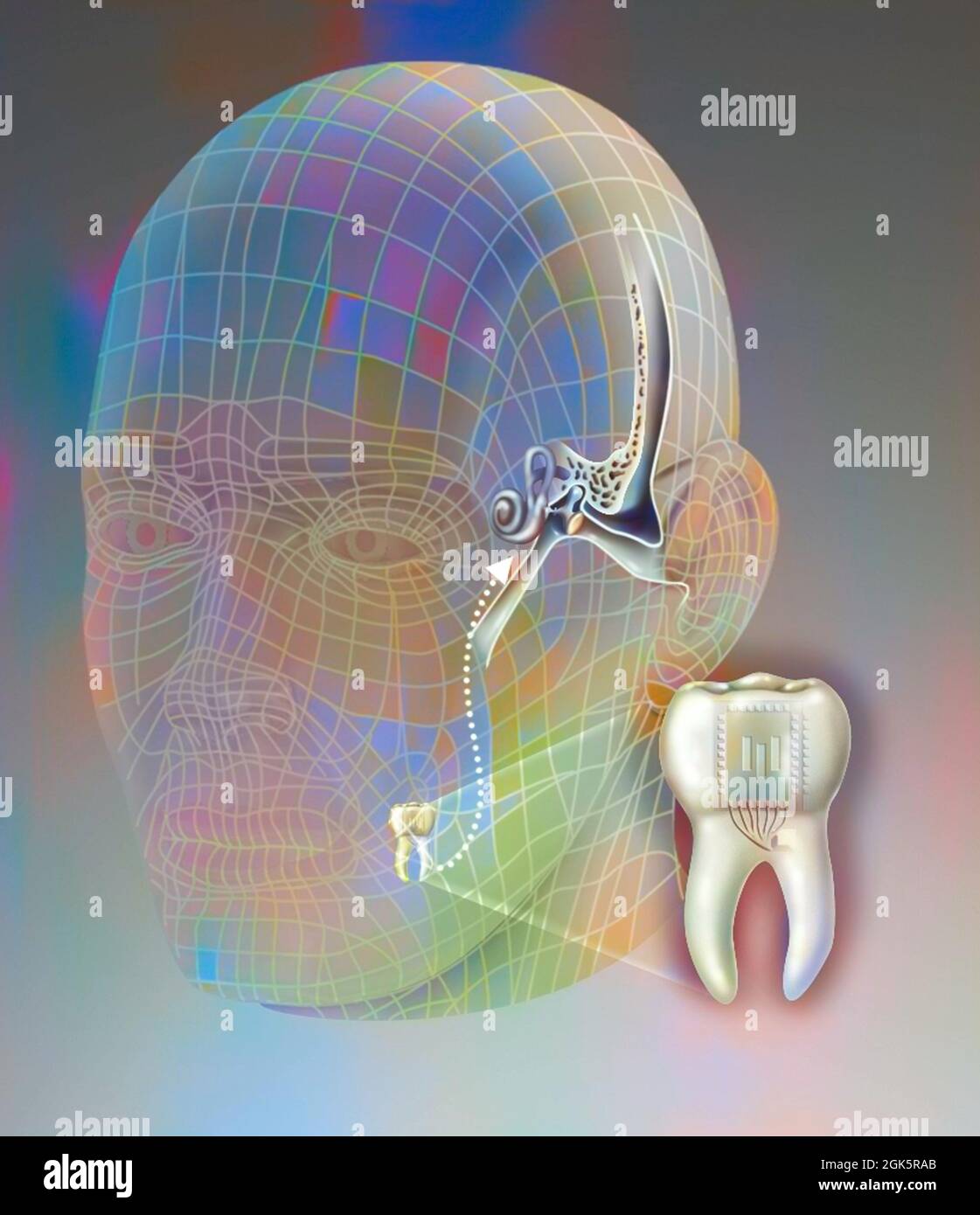 Principle of the dental telephone: sending waves from the tooth to the inner ear. Stock Photo
