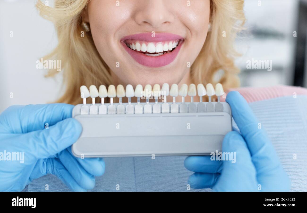 Dentist applying sample from tooth scale to patient white teeth Stock