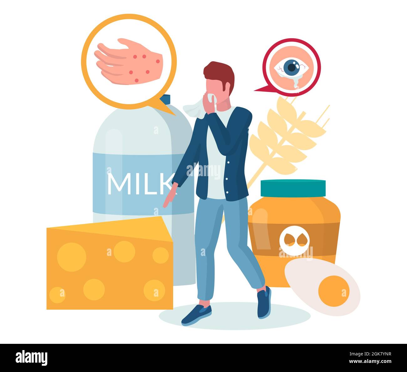 Food allergy. Man suffering from hives, itching red rash, eczema