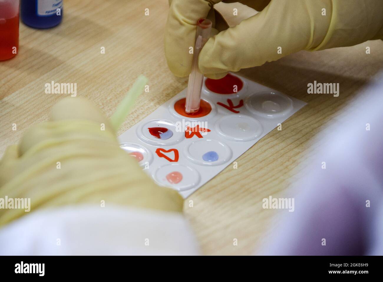 Blood group determination Stock Photo - Alamy