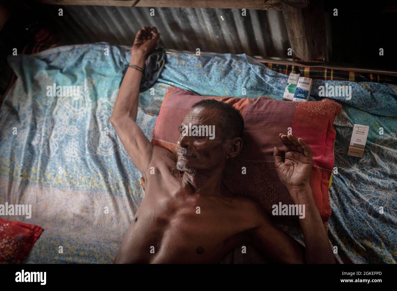 Man on his bed in his hut, next to the pillow are his medicines, he is almost blind and can only breathe with difficulty because he has been drinking Stock Photo