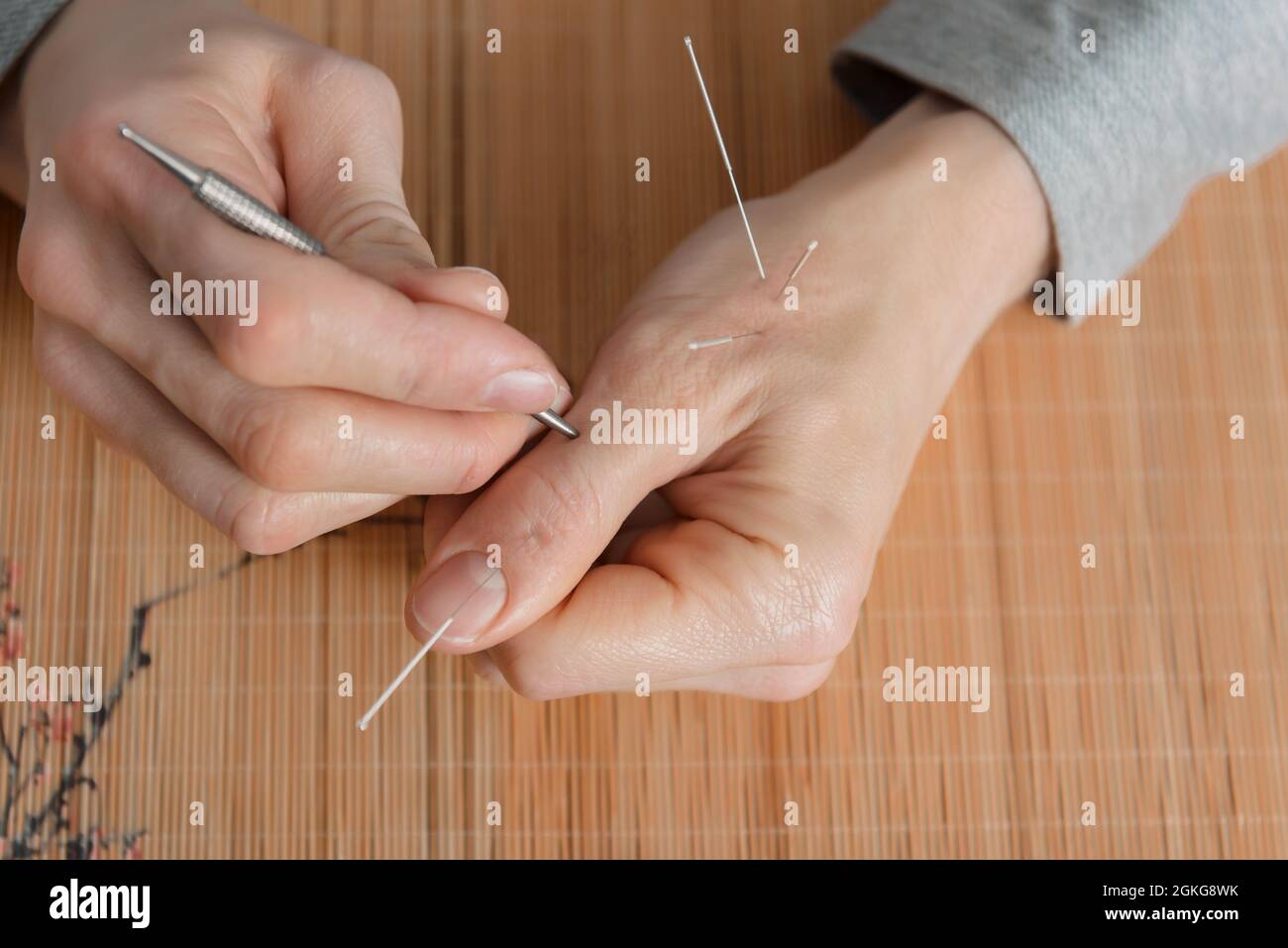 Acupressure Needle Medicine Acupuncture Hi res Stock Photography And 