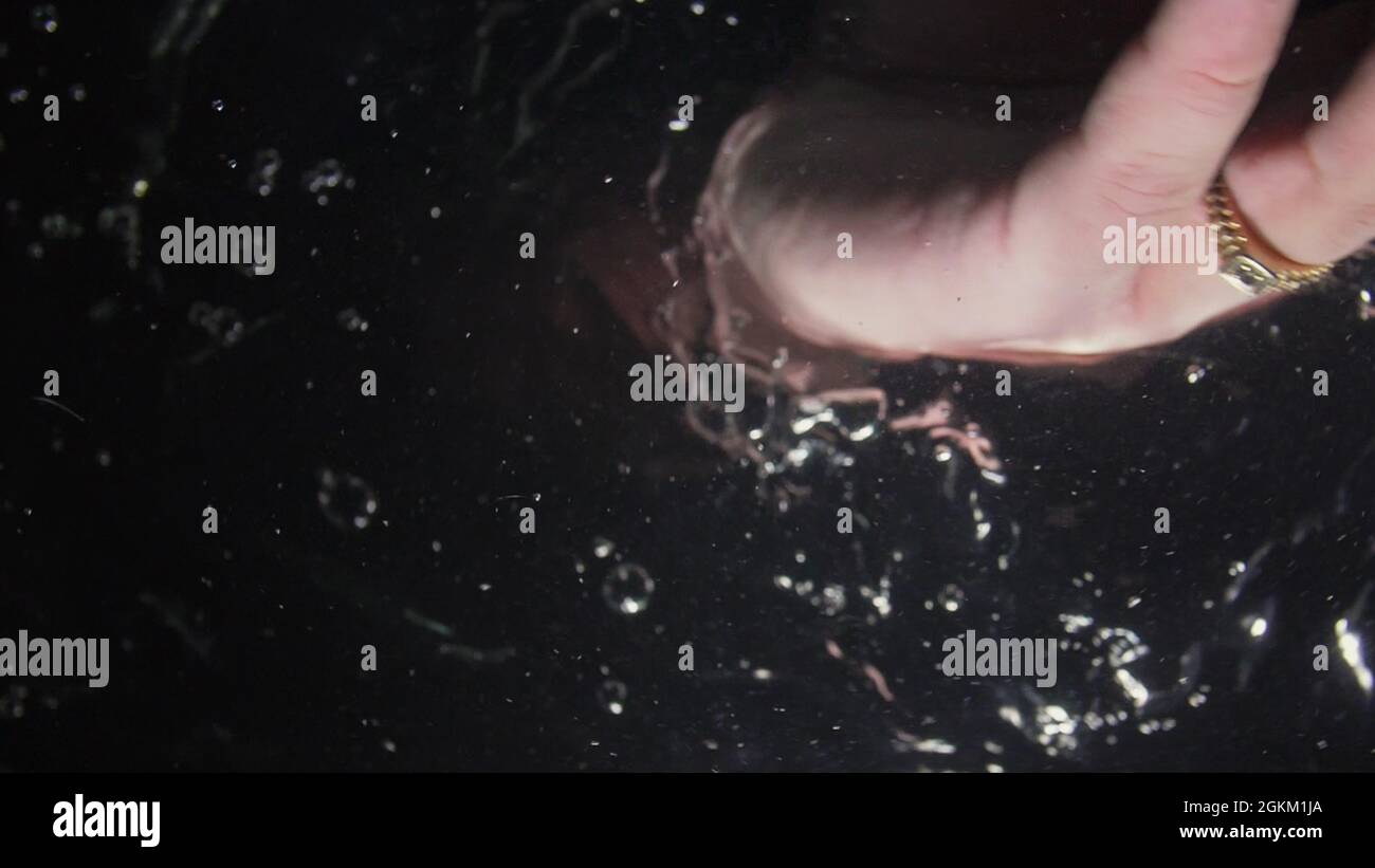 Wearing a ring on your thumb casesany