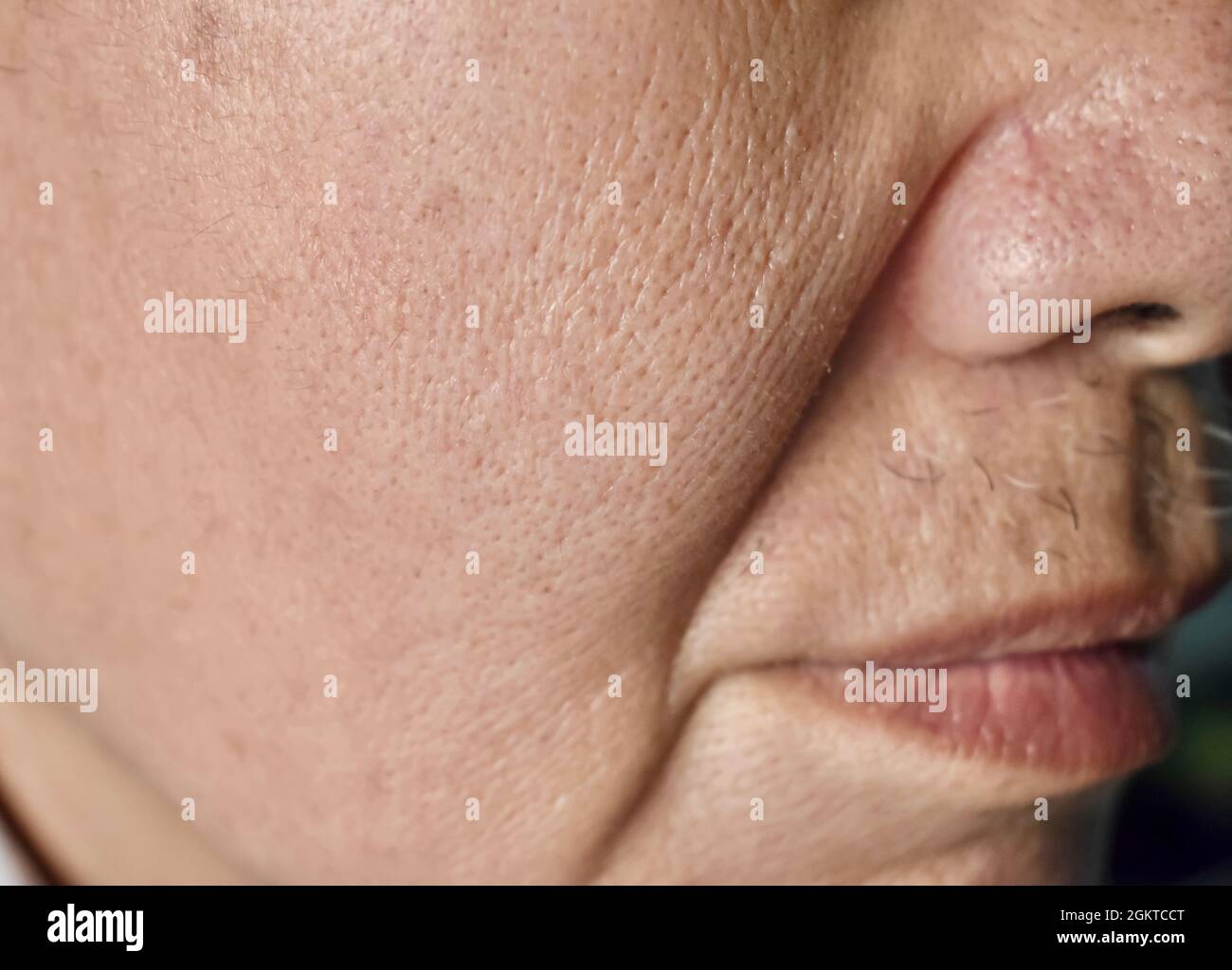 Enlarged pores in face of Southeast Asian, Chinese elder man with skin folds. Stock Photo