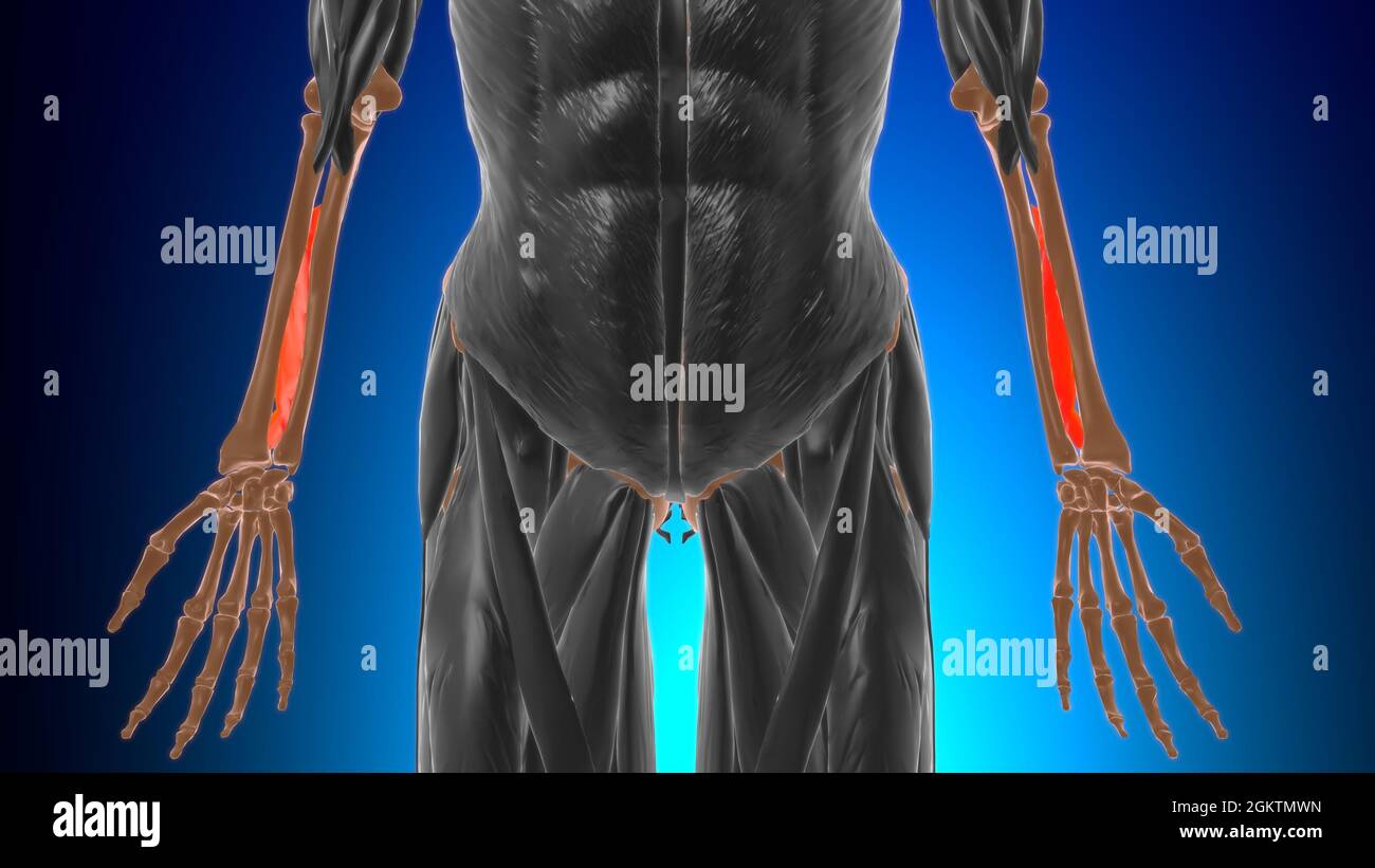 Membrana Interossea Verletzung Clipart