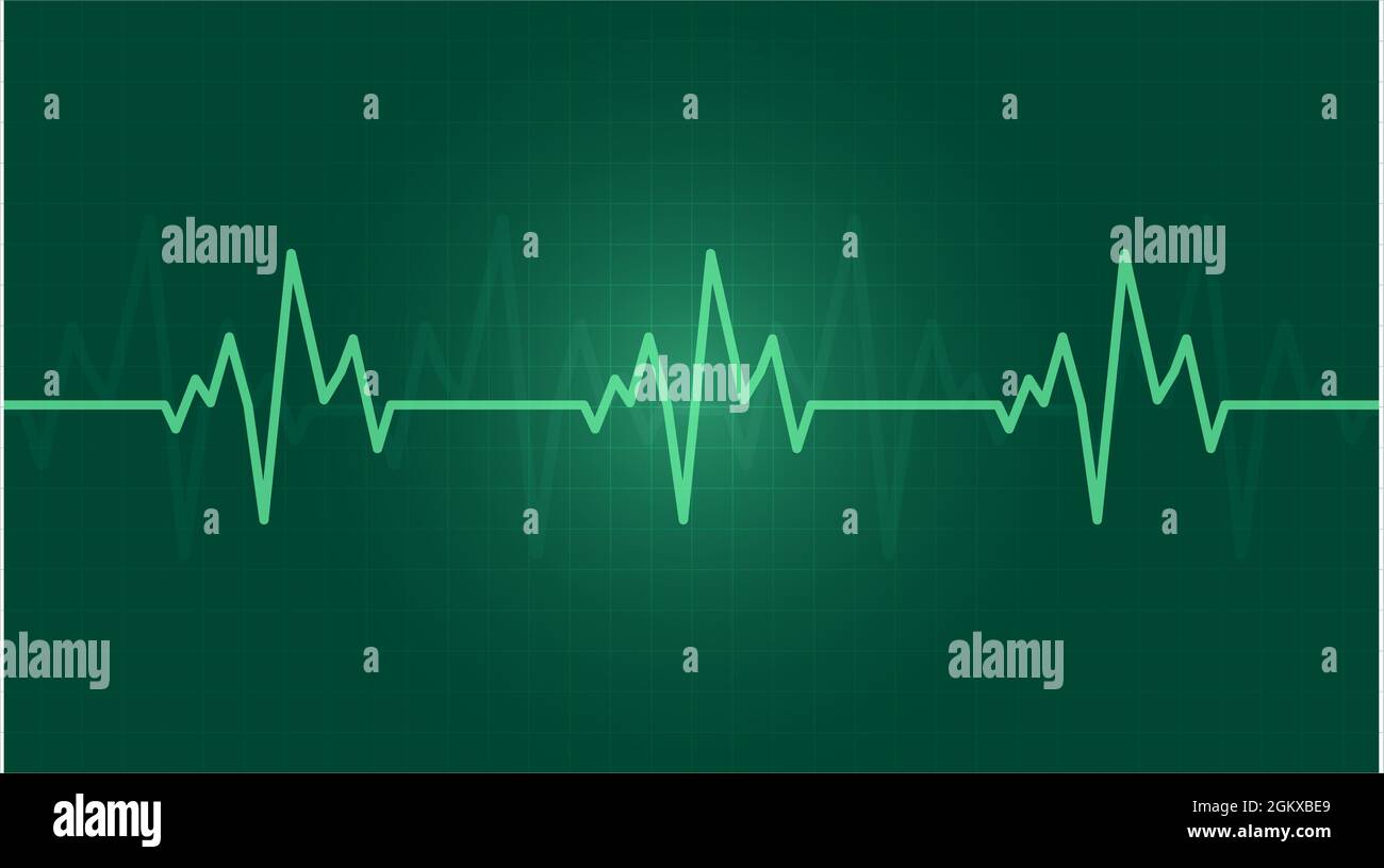 Heartbeat graph hires stock photography and images Alamy