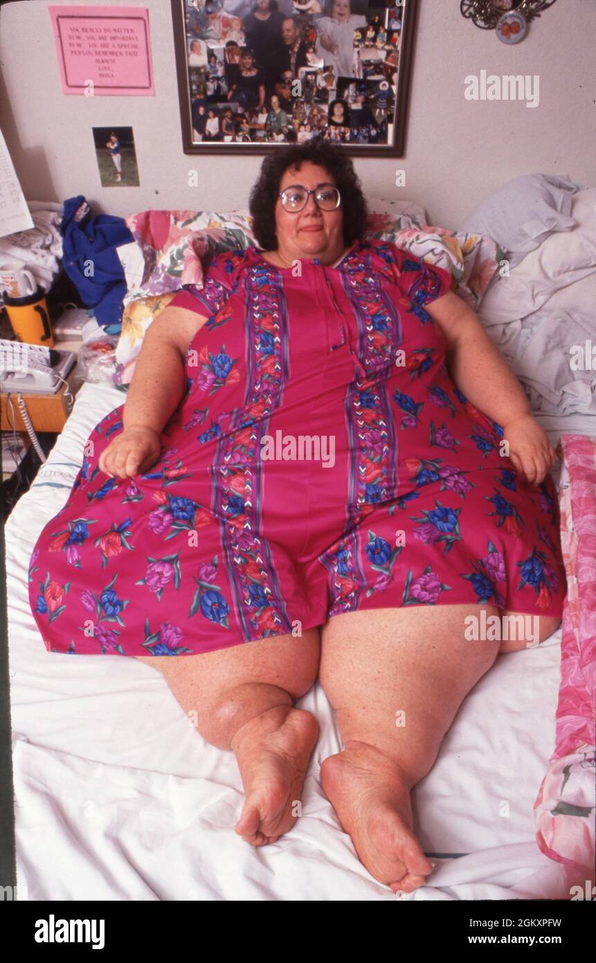 Killeen Texas USA, 1993: Morbidly obese woman weighing 600+ lbs. confined to bed due to her inability to move safely around her house.  MR ©Daemmrich Stock Photo