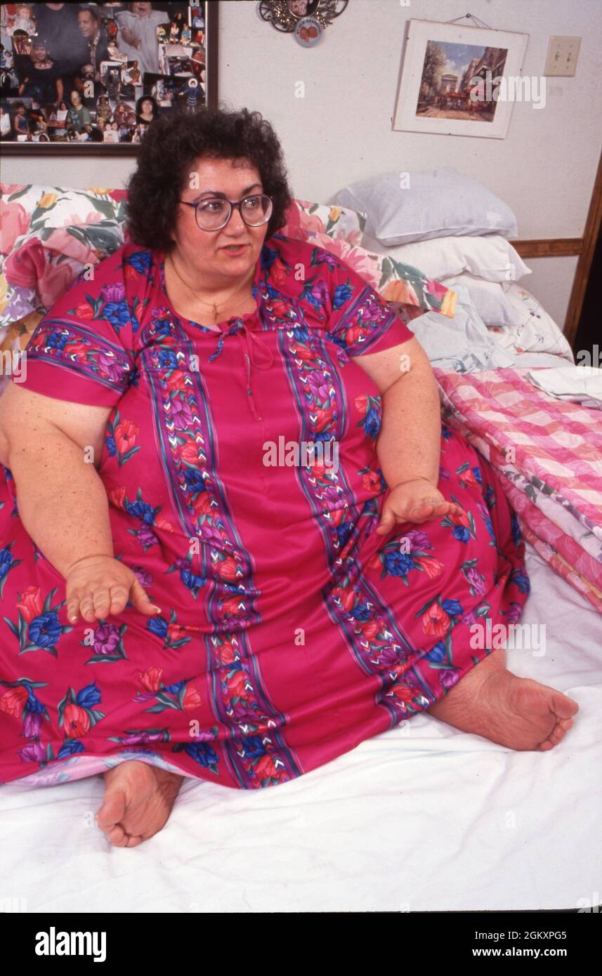 Killeen Texas USA, 1993 Morbidly obese woman weighing 600+ lbs. confined to bed due to her