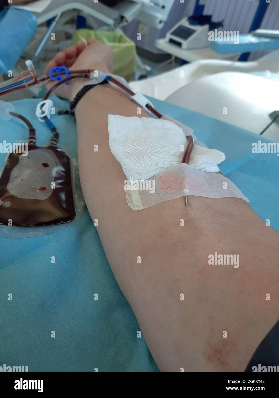 Giving Platelets volunteer adult arm during blood donation for platelet collection ...
