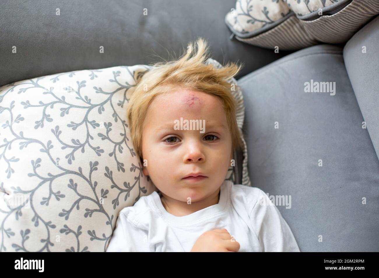 Toddler boy, lying on the couch at home with big bump on the forehead