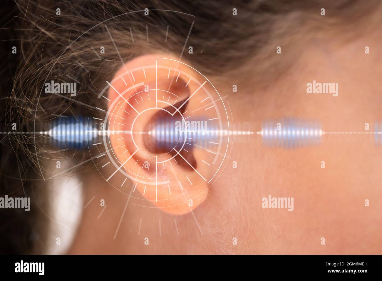 Hearing Aid For Deaf Children. Kid Ear Sound Stock Photo