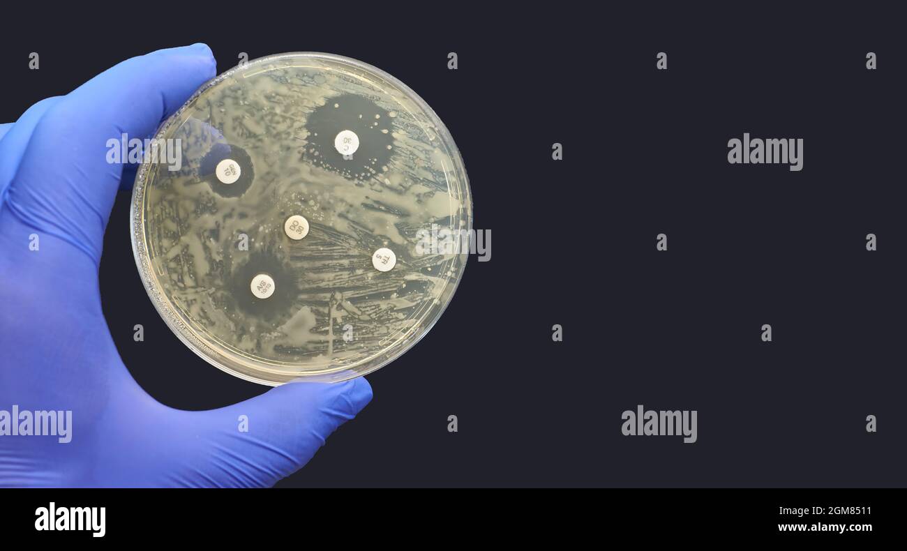 Kirby-Bauer Disk Diffusion Antimicrobial Susceptibility Test black background Stock Photo