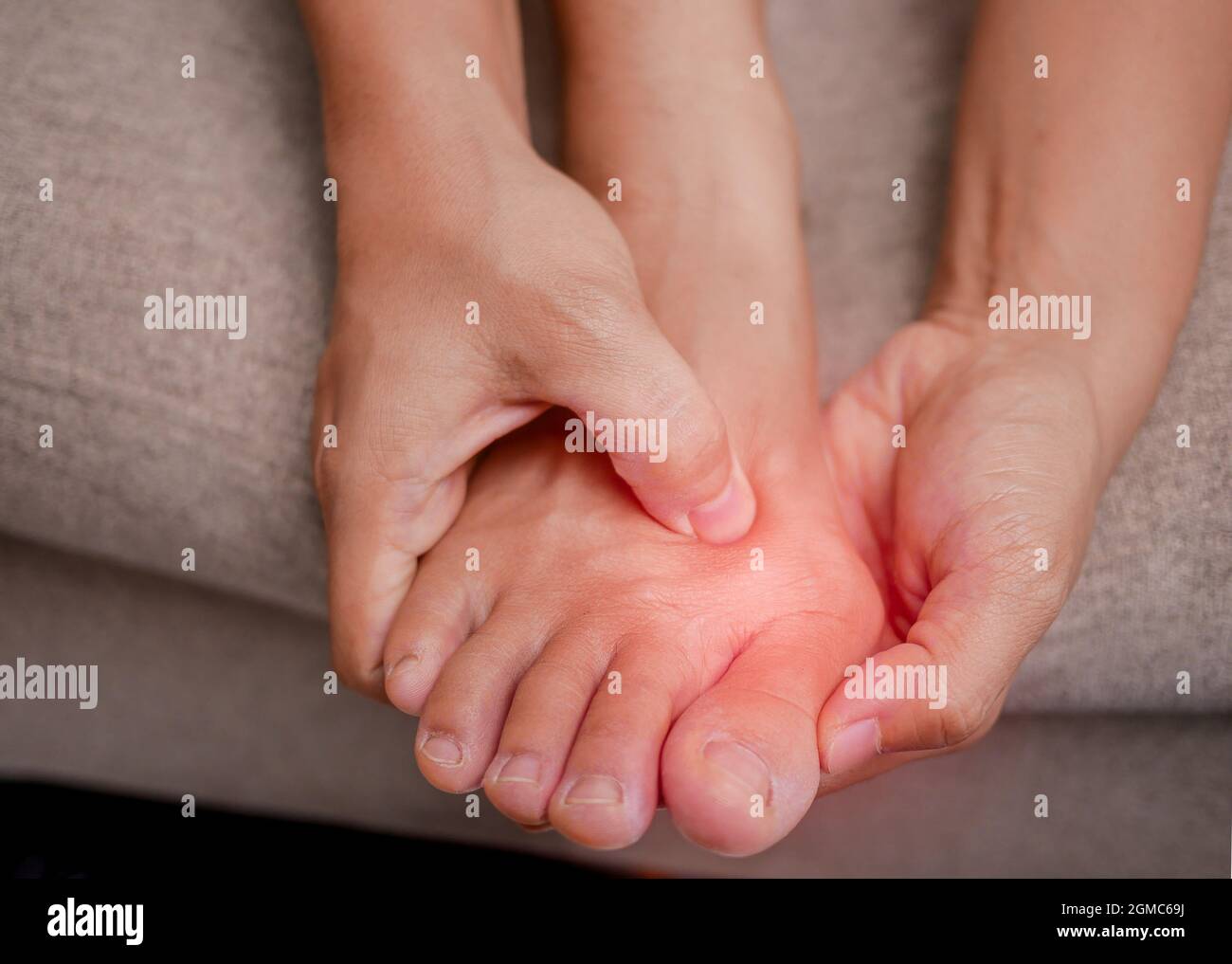 Closeup of female holding her painful feet and massaging her bunion toes to relieve pain. Swollen bunion at the edge of the big toe causes deformity ( Stock Photo