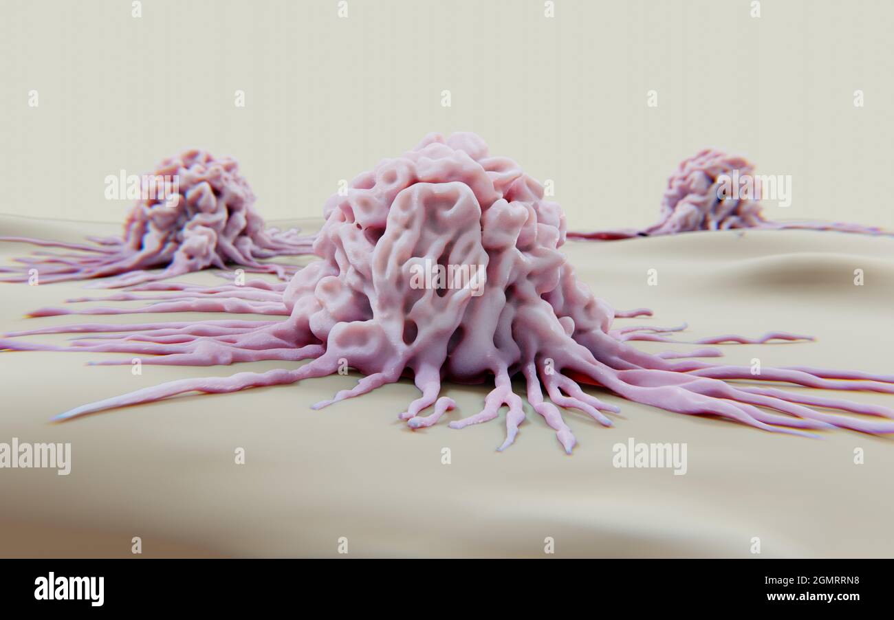 Cancer cells migrating, conceptual illustration Stock Photo