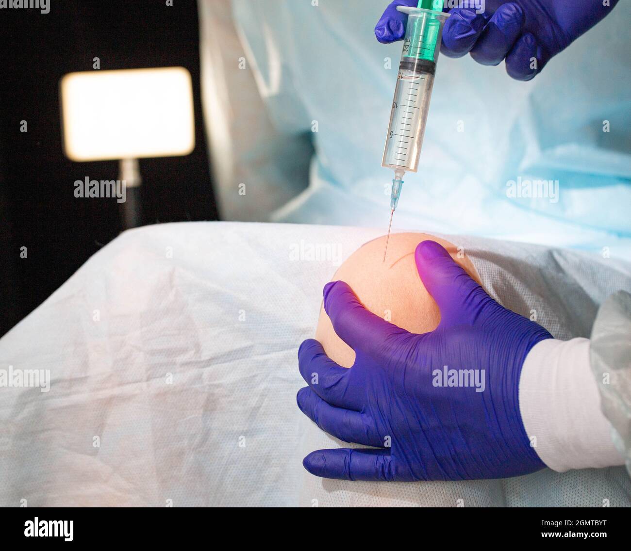 Hyaluronic osteoarthritis hires stock photography and images Alamy