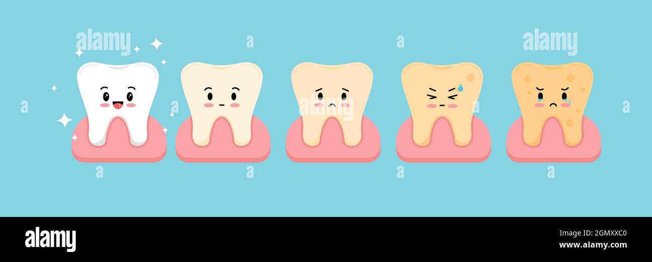 Cute tooth dental plaque stages icon set Stock Vector Image & Art Alamy