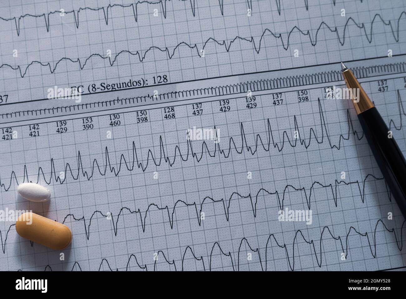 Desk of a doctor. Elements that a cardiologist uses in his work. Patient study material. Stock Photo