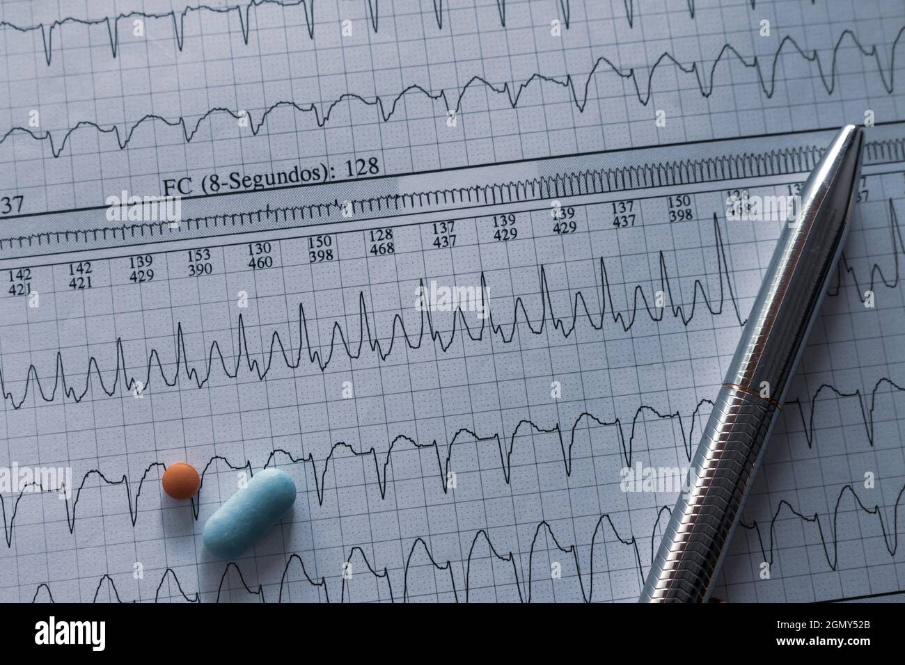 Desk of a doctor. Elements that a cardiologist uses in his work. Patient study material. Stock Photo