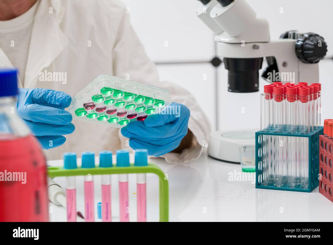A blood test for antibodies in a laboratory to coronavirus covid 19 ...