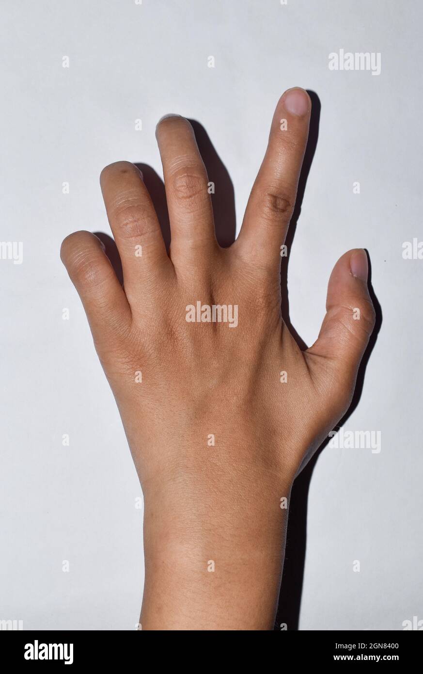 Peripheral neuropathy woman hires stock photography and images Alamy