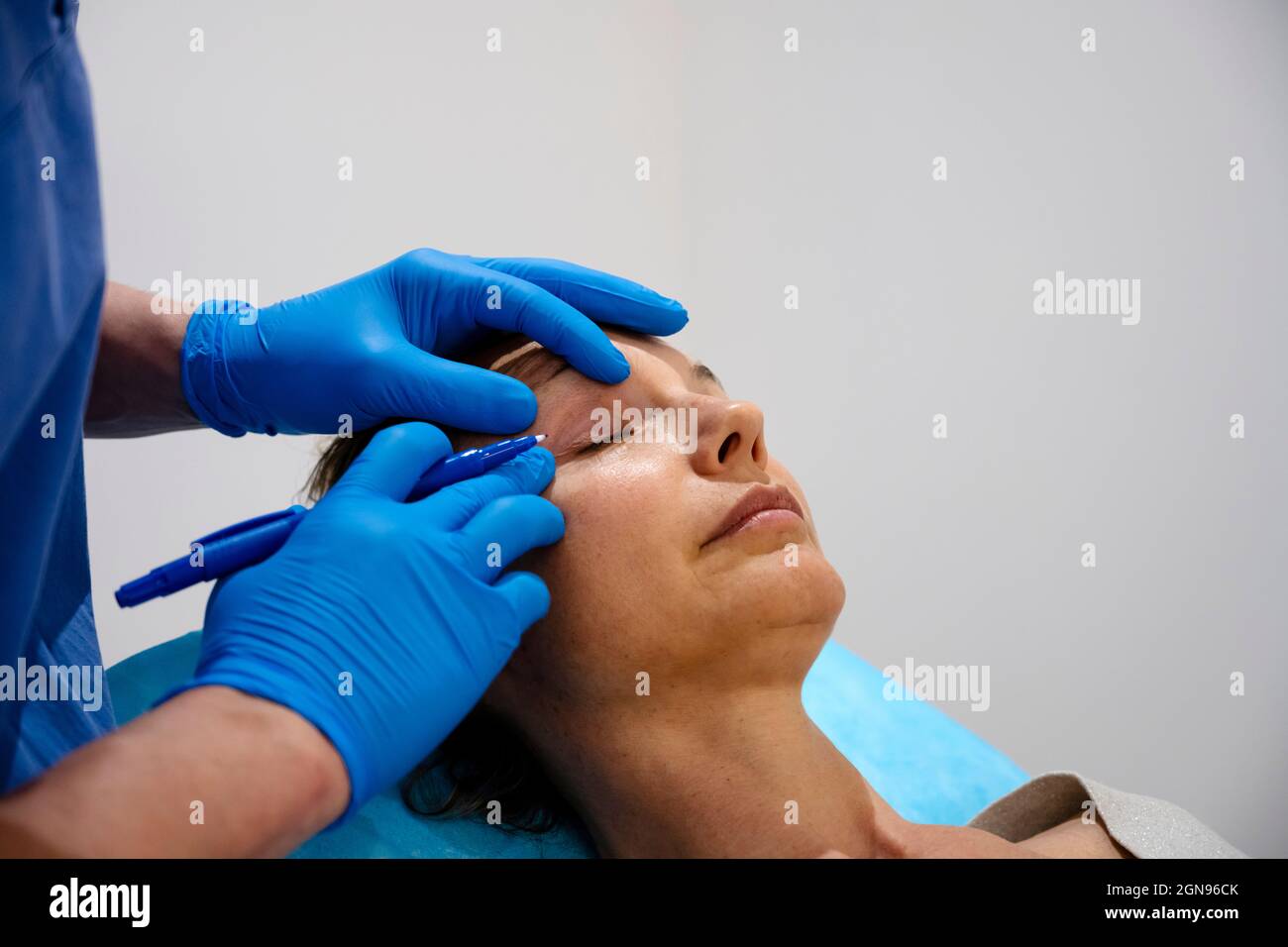 Surgeon drawing line on girl eye with marker preparing for procedure. Stock Photo