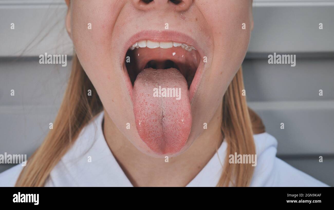 why is my throat closed up