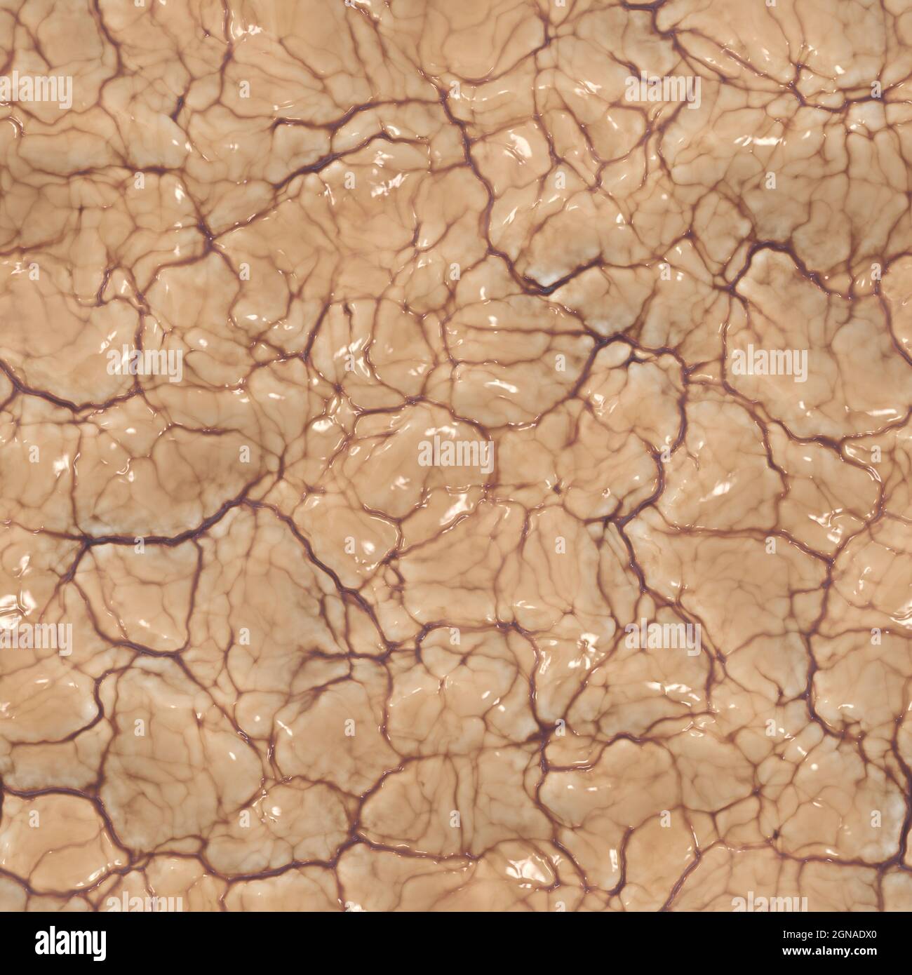 Fatty globules left on the liposuction floor 3D illustration Stock Photo