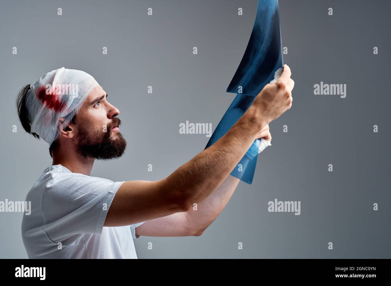 a patient head injury radiology treatment health care Stock Photo Alamy