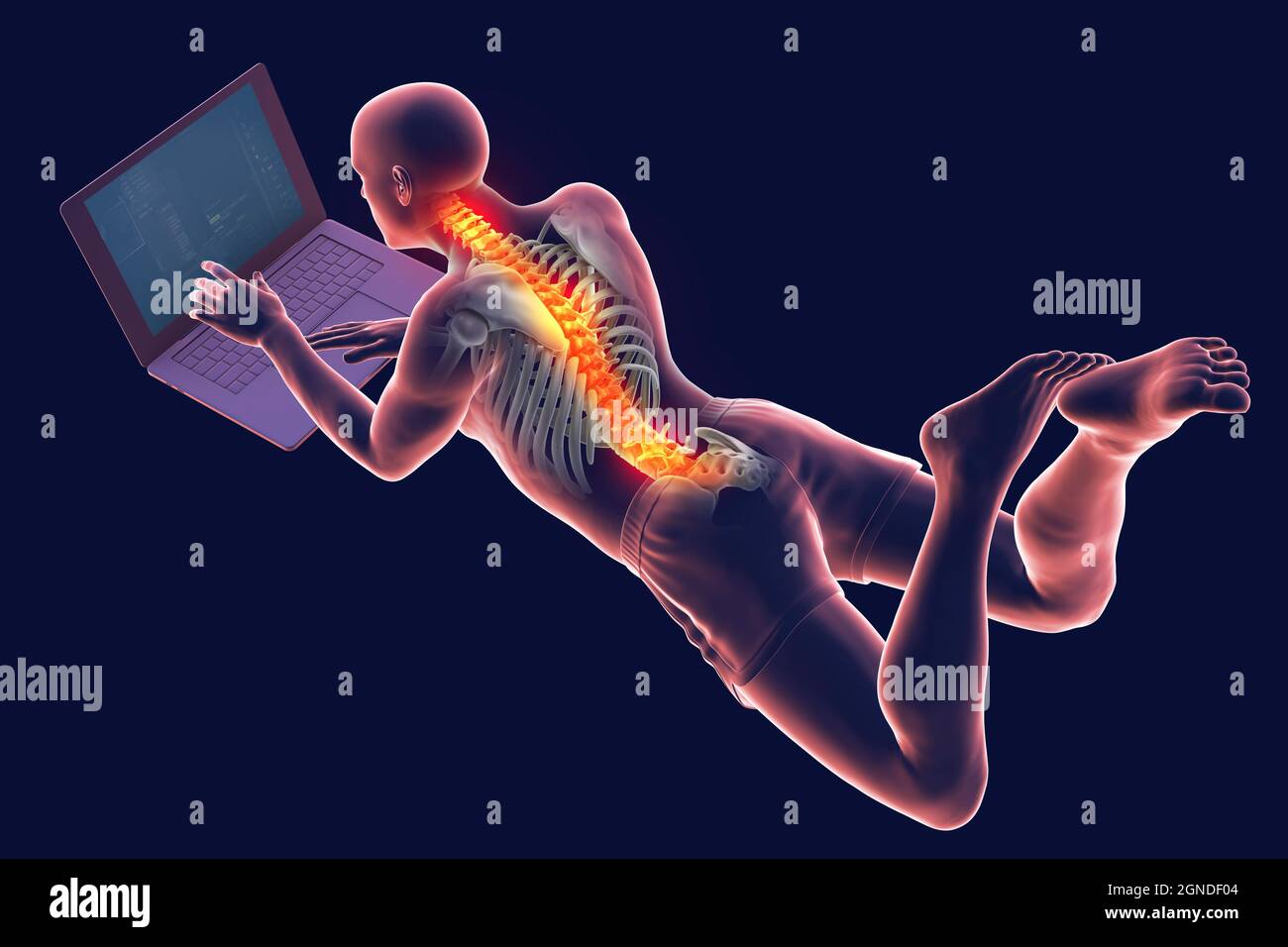 Bad posture whilst using laptop, illustration Stock Photo Alamy