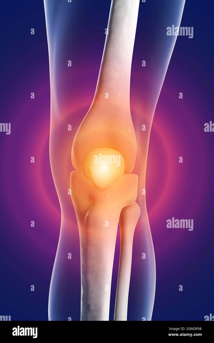 Human knee pain, illustration Stock Photo Alamy