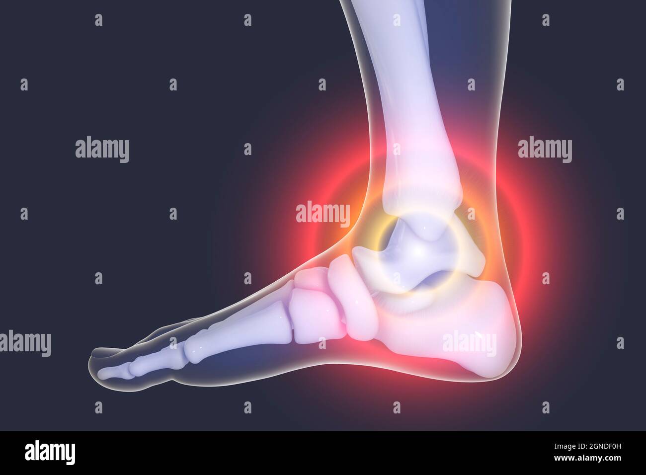 Foot pain, illustration Stock Photo