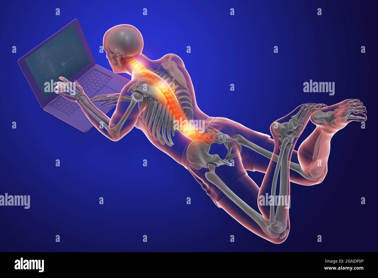 Bad posture whilst using laptop, illustration Stock Photo Alamy