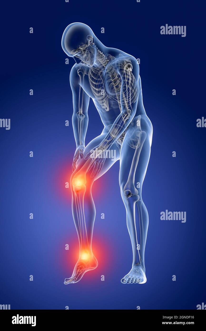 Foot and knee pain, illustration Stock Photo Alamy