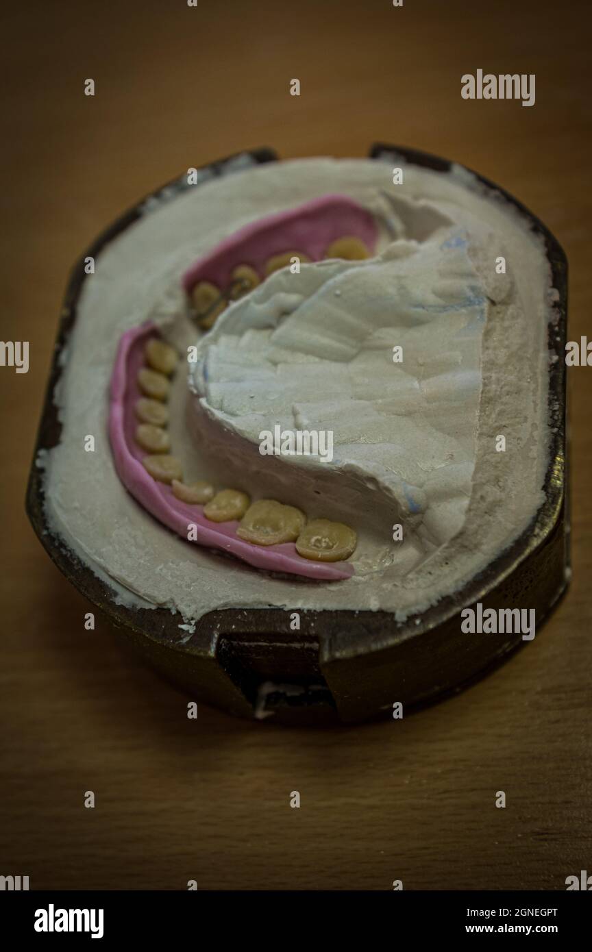 the process of making a person's artificial teeth at a dental technician so that a person can give another a beautiful smile Stock Photo