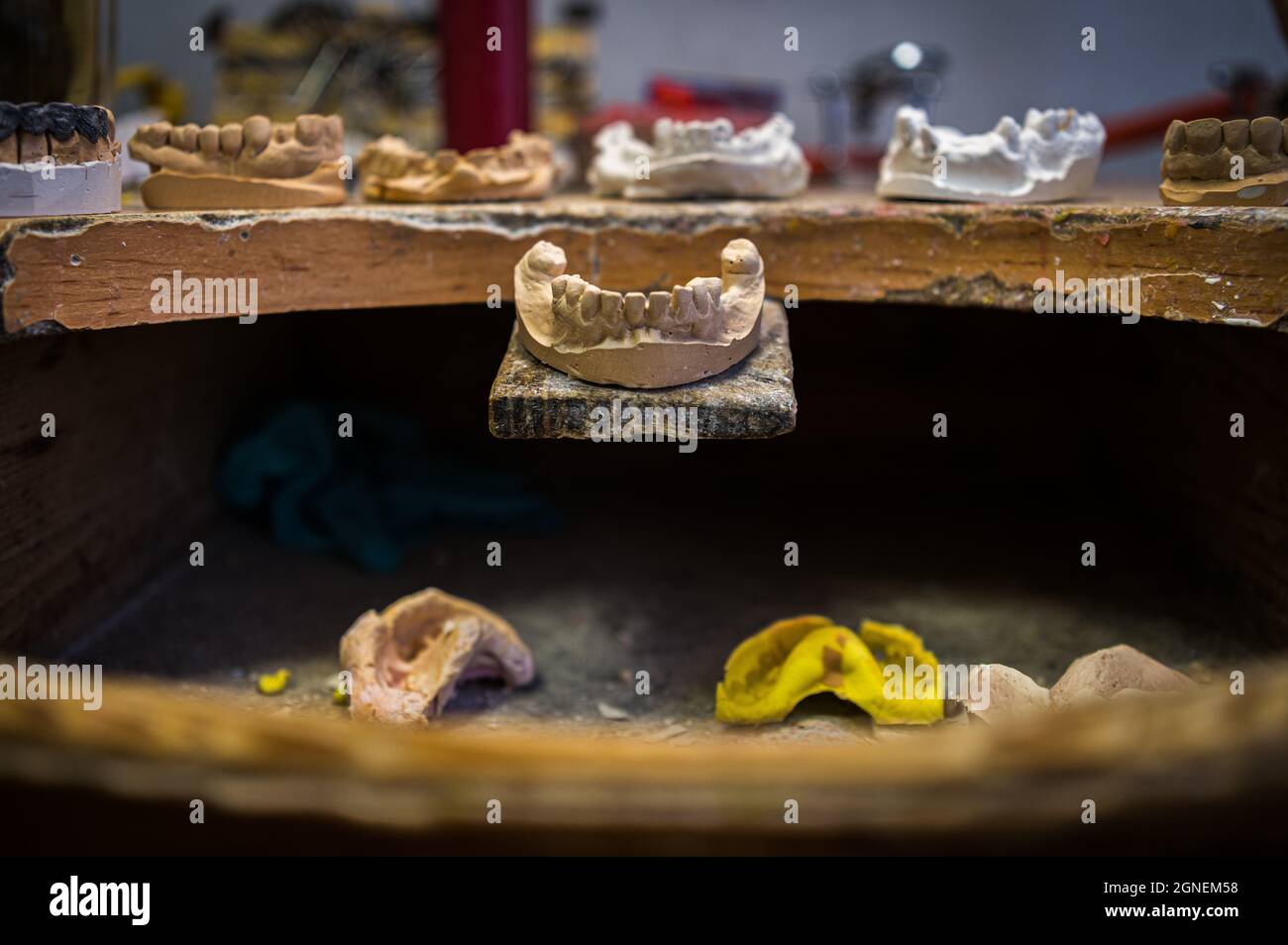 a copy of a person's teeth with a dental technician in the process of making suitable teeth that have fallen out or been pulled out Stock Photo